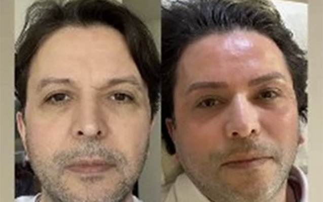 Nihat yeni görünüşü ilə gündəm oldu - FOTOLAR