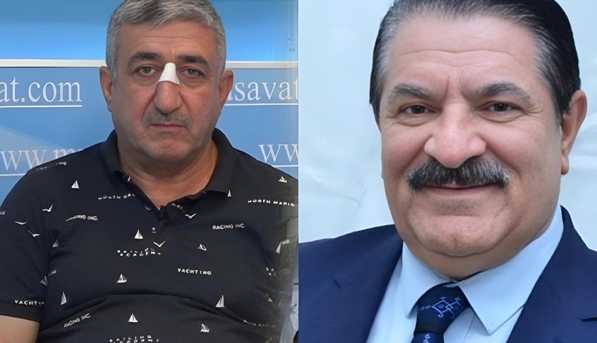 Ağadadaşın balta atdığı mühafizəçi əxlaqsız hərəkətə görə həbs edilib