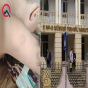 Xüsusi məktəbdə müəllim azyaşlıya şiddət göstərib? - FOTO