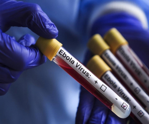 ABŞ-dən Ebola ilə bağlı - Xəbərdarlıq