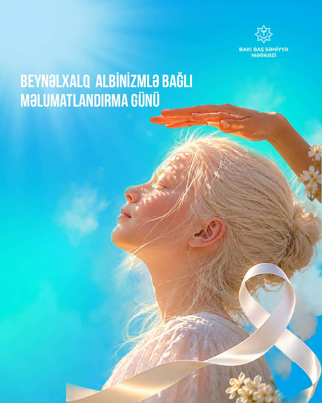 Bu gün Beynəlxalq Albinizm haqqında Maarifləndirmə Günüdür