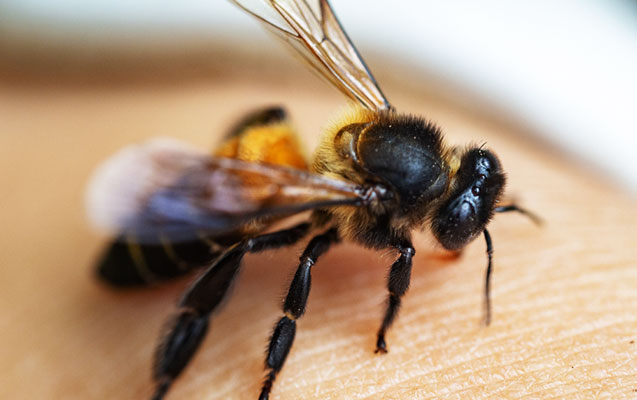 50 yaşlı kişini arı sancdı - Şoka düşdü